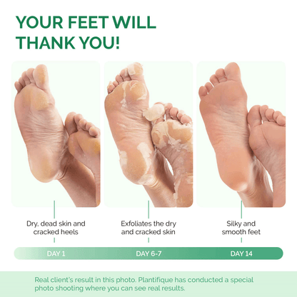 The Peach Foot Peel Mask (2 Pack)